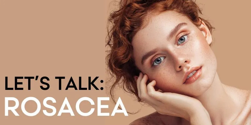 Let's talk: Rosacea