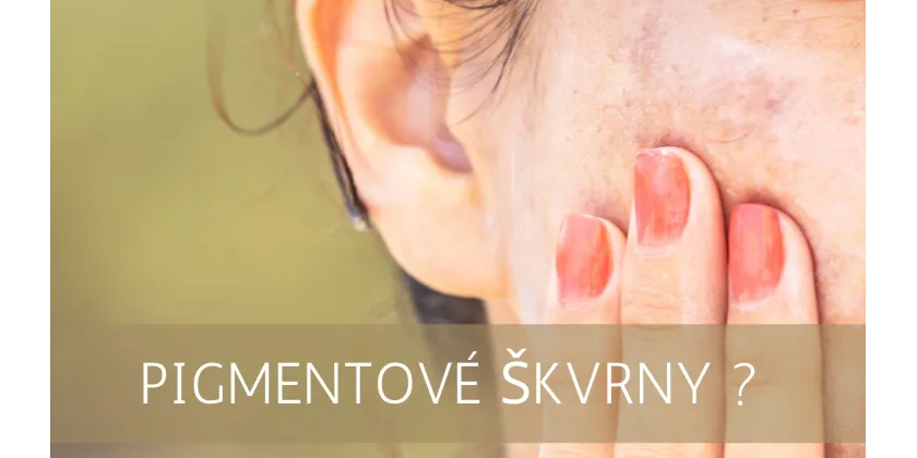 Hyperpigmentation - an aesthetic problem