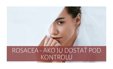 Rosacea - how to get it under control