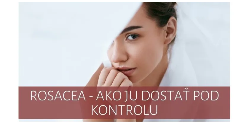 Rosacea - how to get it under control